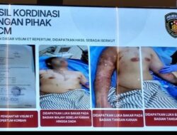 RSCM Pastikan Kondisi Aktivis KontraS Andrie Yunus Korban Penyiraman Air Keras Sudah Stabil